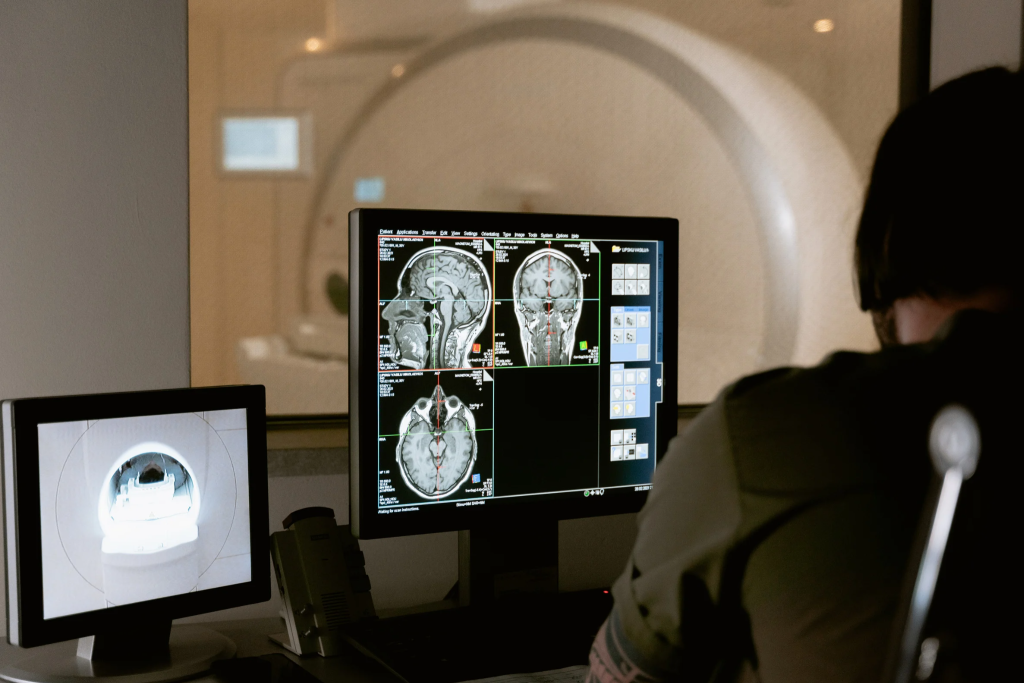 Image of an MRI scan that can be read by a AI in future